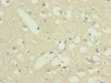 Immunohistochemistry of paraffin-embedded human brain tissue using CSB-PA836171ESR2HU at dilution of 1:100