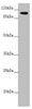 Western blot<br />
 All lanes: TTLL7 antibody at 2.6µg/ml + A549 whole cell lysate<br />
 Secondary<br />
 Goat polyclonal to rabbit IgG at 1/10000 dilution<br />
 Predicted band size: 103, 78, 93 kDa<br />
 Observed band size: 103 kDa<br />