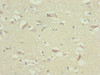 Immunohistochemistry of paraffin-embedded human brain tissue using CSB-PA765082ESR1HU at dilution of 1:100