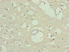 Immunohistochemistry of paraffin-embedded human brain tissue using CSB-PA765082ESR2HU at dilution of 1:100