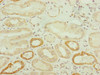 Immunohistochemistry of paraffin-embedded human kidney tissue using CSB-PA848823DSR1HU at dilution of 1:100