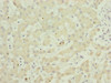 Immunohistochemistry of paraffin-embedded human liver tissue using CSB-PA848823DSR1HU at dilution of 1:100