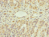 Immunohistochemistry of paraffin-embedded human adrenal gland tissue using CSB-PA880062ESR1HU at dilution of 1:100