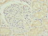 Immunohistochemistry of paraffin-embedded human kidney tissue using CSB-PA856905ESR1HU at dilution of 1:100