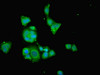Immunofluorescent analysis of PC-3 cells using CSB-PA856905ESR1HU at dilution of 1:100 and Alexa Fluor 488-congugated AffiniPure Goat Anti-Rabbit IgG (H+L)