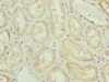 Immunohistochemistry of paraffin-embedded human kidney tissue using CSB-PA856905ESR2HU at dilution of 1:100