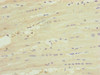 Immunohistochemistry of paraffin-embedded human heart tissue using CSB-PA866268ESR1HU at dilution of 1:100