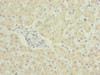 Immunohistochemistry of paraffin-embedded human liver tissue using CSB-PA866268ESR2HU at dilution of 1:100