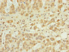 Immunohistochemistry of paraffin-embedded human adrenal gland tissue using CSB-PA822707ESR2HU at dilution of 1:100