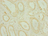 Immunohistochemistry of paraffin-embedded human kidney tissue using CSB-PA873679ESR1HU at dilution of 1:100