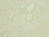 Immunohistochemistry of paraffin-embedded human kidney tissue using CSB-PA873679ESR2HU at dilution of 1:100