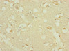 Immunohistochemistry of paraffin-embedded human brain tissue using CSB-PA842685ESR1HU at dilution of 1:100