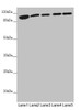 Western blot<br />
 All lanes: DHTKD1 antibody at 1.81µg/ml<br />
 Lane 1: Mouse liver tissue<br />
 Lane 2: Mouse kidney tissue<br />
 Lane 3: A431 whole cell lysate<br />
 Lane 4: MCF-7 whole cell lysate<br />
 Lane 5: HepG2 whole cell lysate<br />
 Secondary<br />
 Goat polyclonal to rabbit IgG at 1/10000 dilution<br />
 Predicted band size: 103 kDa<br />
 Observed band size: 103 kDa<br />