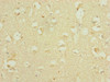 Immunohistochemistry of paraffin-embedded human brain tissue using CSB-PA842685ESR2HU at dilution of 1:100