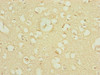 Immunohistochemistry of paraffin-embedded human brain tissue using CSB-PA853400ESR1HU at dilution of 1:100