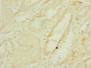 Immunohistochemistry of paraffin-embedded human kidney tissue using CSB-PA853400ESR1HU at dilution of 1:100