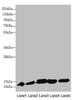 Western blot<br />
 All lanes: DNAJC19 antibody at 0.9µg/ml<br />
 Lane 1: Mouse lung tissue<br />
 Lane 2: Mouse kidney tissue<br />
 Lane 3: A549 whole cell lysate<br />
 Lane 4: HL60 whole cell lysate<br />
 Lane 5: Hela whole cell lysate<br />
 Secondary<br />
 Goat polyclonal to rabbit IgG at 1/10000 dilution<br />
 Predicted band size: 13, 11 kDa<br />
 Observed band size: 13 kDa<br />