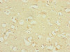 Immunohistochemistry of paraffin-embedded human brain tissue using CSB-PA853400ESR2HU at dilution of 1:100