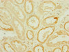 Immunohistochemistry of paraffin-embedded human kidney tissue using CSB-PA853400ESR2HU at dilution of 1:100