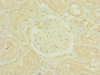 Immunohistochemistry of paraffin-embedded human kidney tissue using CSB-PA896532ESR1HU at dilution of 1:100