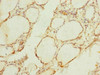 Immunohistochemistry of paraffin-embedded human thyroid tissue using CSB-PA896532ESR1HU at dilution of 1:100