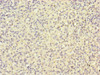 Immunohistochemistry of paraffin-embedded human spleen tissue using CSB-PA010471ESR1HU at dilution of 1:100