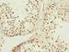 Immunohistochemistry of paraffin-embedded human testis tissue using CSB-PA012187ESR1HU at dilution of 1:100