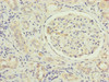 Immunohistochemistry of paraffin-embedded human kidney tissue using CSB-PA812879ESR1HU at dilution of 1:100