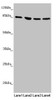 Western blot<br />
 All lanes: MFN1 antibody at 1.1µg/ml<br />
 Lane 1: Human placenta tissue<br />
 Lane 2: Jurkat whole cell lysate<br />
 Lane 3: Hela whole cell lysate<br />
 Lane 4: K562 whole cell lysate<br />
 Secondary<br />
 Goat polyclonal to rabbit IgG at 1/10000 dilution<br />
 Predicted band size: 85, 42, 72 kDa<br />
 Observed band size: 85 kDa<br />