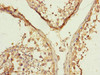 Immunohistochemistry of paraffin-embedded human testis tissue using CSB-PA812879ESR2HU at dilution of 1:100