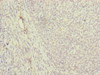Immunohistochemistry of paraffin-embedded human tonsil tissue using CSB-PA897105ESR1HU at dilution of 1:100