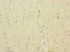 Immunohistochemistry of paraffin-embedded human heart tissue using CSB-PA897105ESR1HU at dilution of 1:100