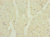 Immunohistochemistry of paraffin-embedded human heart tissue using CSB-PA897105ESR2HU at dilution of 1:100