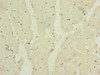 Immunohistochemistry of paraffin-embedded human heart tissue using CSB-PA897105ESR2HU at dilution of 1:100