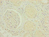 Immunohistochemistry of paraffin-embedded human kidney tissue using CSB-PA014937ESR1HU at dilution of 1:100