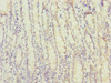 Immunohistochemistry of paraffin-embedded human small intestine tissue using CSB-PA669874ESR1HU at dilution of 1:100