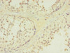 Immunohistochemistry of paraffin-embedded human testis tissue using CSB-PA669874ESR1HU at dilution of 1:100