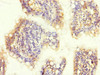 Immunohistochemistry of paraffin-embedded human small intestine tissue using CSB-PA669874ESR2HU at dilution of 1:100