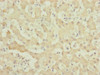 Immunohistochemistry of paraffin-embedded human liver tissue using CSB-PA892471ESR1HU at dilution of 1:100
