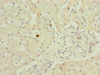 Immunohistochemistry of paraffin-embedded human liver tissue using CSB-PA892471ESR2HU at dilution of 1:100