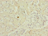Immunohistochemistry of paraffin-embedded human liver tissue using CSB-PA892471ESR2HU at dilution of 1:100 Immunohistochemistry of paraffin-embedded human liver tissue using CSB-PA892471ESR2HU at dilution of 1:100