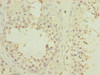 Immunohistochemistry of paraffin-embedded human testis tissue using CSB-PA017716ESR1HU at dilution of 1:100