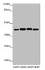 Western blot<br />
 All lanes: PDHA2 antibody at 1.9µg/ml<br />
 Lane 1: Mouse gonadal tissue<br />
 Lane 2: 293T whole cell lysate<br />
 Lane 3: A549 whole cell lysate<br />
 Lane 4: HepG2 whole cell lysate<br />
 Secondary<br />
 Goat polyclonal to rabbit IgG at 1/10000 dilution<br />
 Predicted band size: 43 kDa<br />
 Observed band size: 43 kDa<br />