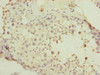 Immunohistochemistry of paraffin-embedded human testis tissue using CSB-PA017716ESR2HU at dilution of 1:100