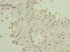 Immunohistochemistry of paraffin-embedded human testis tissue using CSB-PA018243ESR1HU at dilution of 1:100