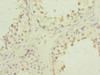 Immunohistochemistry of paraffin-embedded human testis tissue using CSB-PA018243ESR2HU at dilution of 1:100
