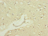 Immunohistochemistry of paraffin-embedded human brain tissue using CSB-PA018373ESR1HU at dilution of 1:100