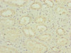 Immunohistochemistry of paraffin-embedded human kidney tissue using CSB-PA018373ESR1HU at dilution of 1:100