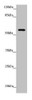 Western blot<br />
 All lanes: QRSL1 antibody at 2.05µg/ml + MCF-7 whole cell lysate<br />
 Secondary<br />
 Goat polyclonal to rabbit IgG at 1/10000 dilution<br />
 Predicted band size: 58, 33 kDa<br />
 Observed band size: 58 kDa<br />