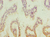 Immunohistochemistry of paraffin-embedded human small intestine tissue using CSB-PA887948ESR1HU at dilution of 1:100